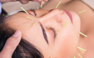Facial Acupuncture: A Natural Path to Radiant Skin